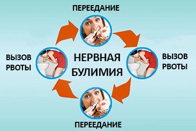 Лечение булимии в Нижнем Одесе